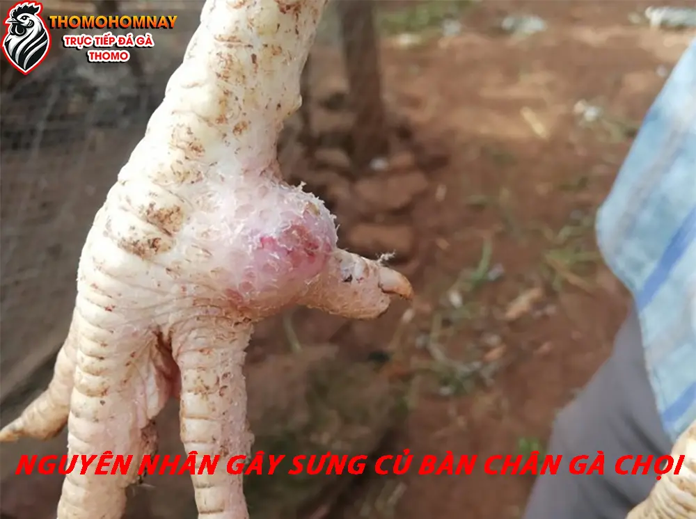 Nguyên nhân gây sưng củ bàn chân gà chọi và cách phòng ngừa