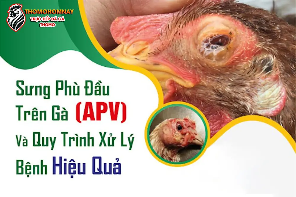 Phương pháp và lưu ý quan trọng khi điều trị bệnh APV
