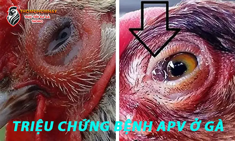 Triệu chứng bệnh APV ở gà